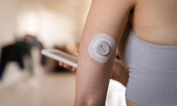 Close-up of Dexcom G7 sensor applied on arm